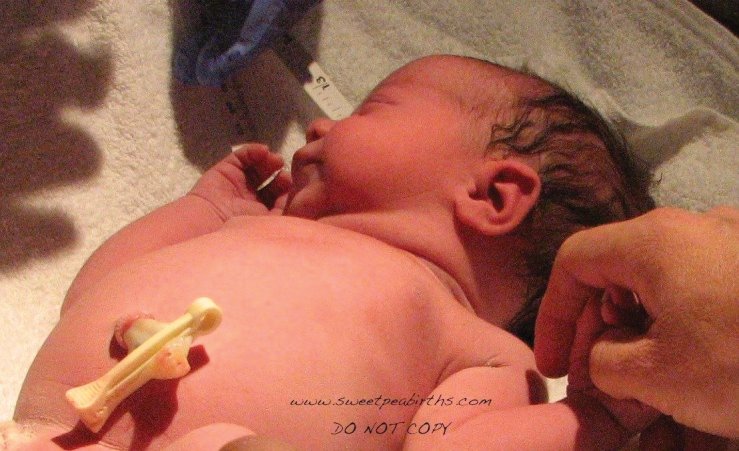 Cord Clamping