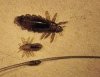 Head Lice 